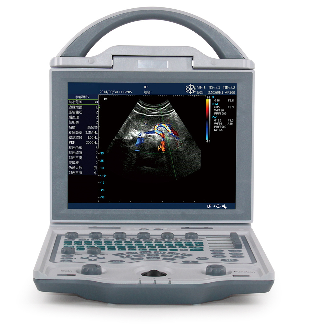 Veterinary Ultrasound Machine VMCPU12