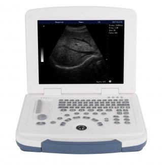 Portable Ultrasound Machine VMBPU01